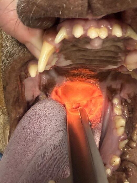 Elongated soft palate before surgical shortening